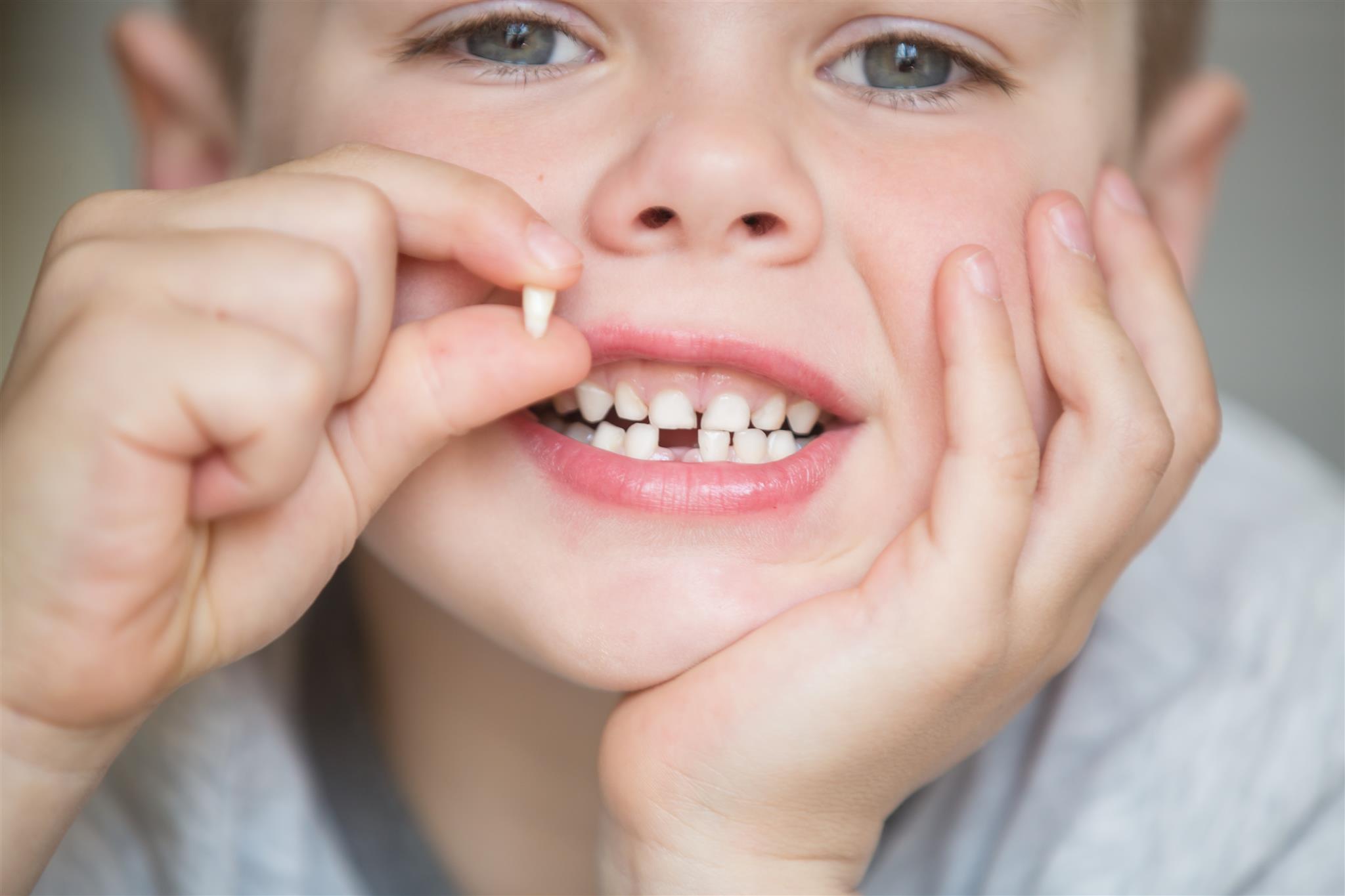 Denti Da Latte Perch Importante Non Sottovalutarli Centro 